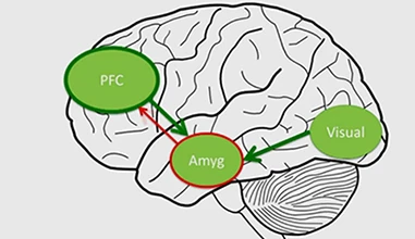 Are depressive and anxiety disorders visible in the adolescent brain?